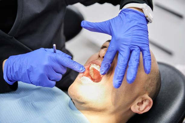 Best Broken or Cracked Tooth Emergency Dentist in Wahpeton, ND